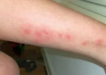 No Signs of Bed Bugs but I Have Bites